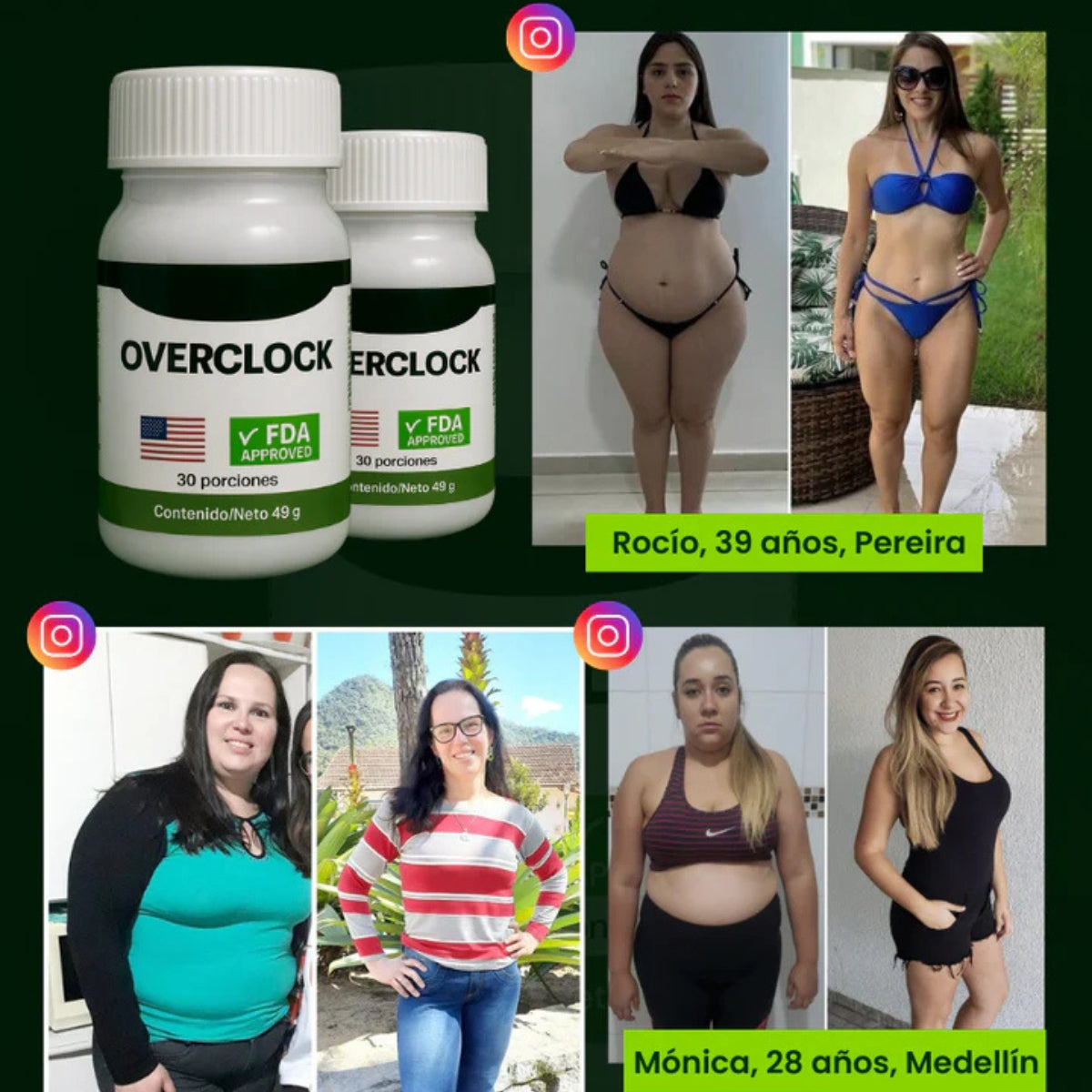 OverClock™ – Potente Adelgazante y Anticelulítico - OFERTA 2x1