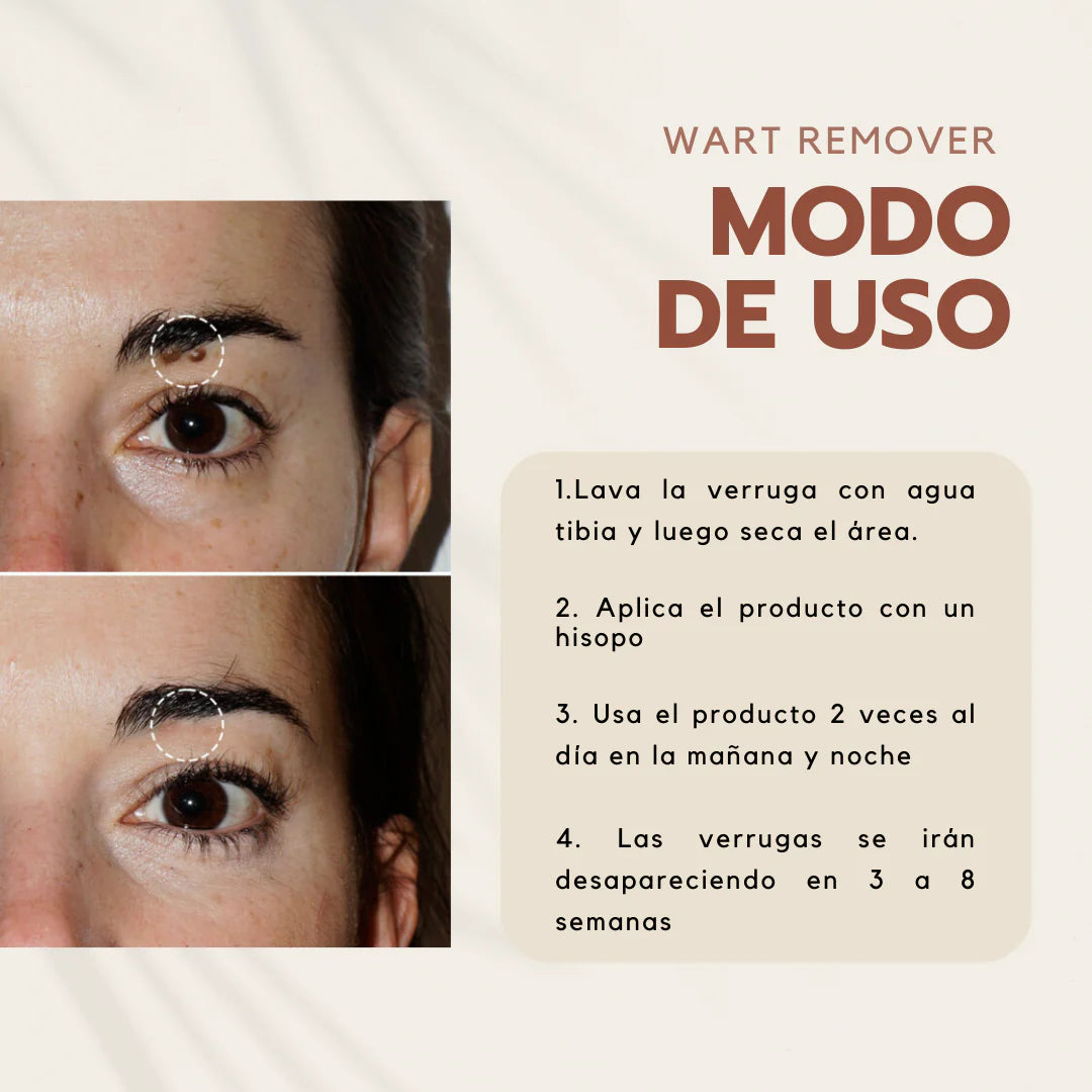 Wart Remover | Removedor de verrugas y lunares