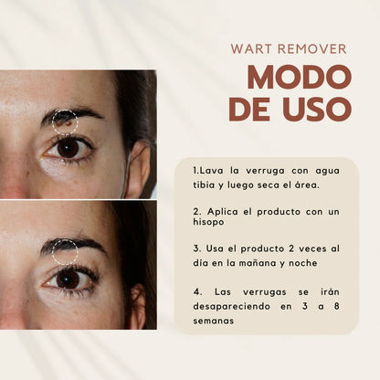 Wart Remover | Removedor de verrugas y lunares