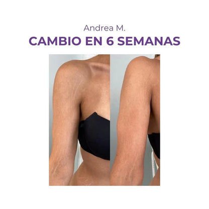 Crema AntiEstrías - EMILY