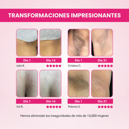 EternaGlow - Crema Aclarante