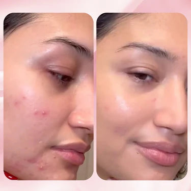 Medicube - Mascarilla de Colágeno